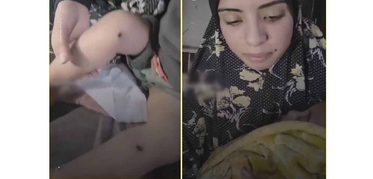 الرضيع كريم وأمه